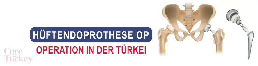 Hüftendoprothese op in der Türkei