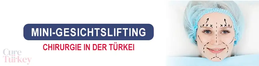 Mini-Gesichtslifting in der Türkei