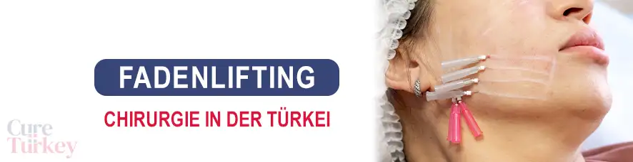 Fadenlifting in der Türkei