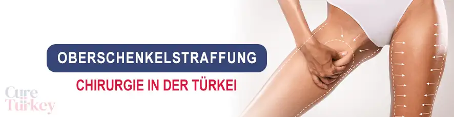 Oberschenkelstraffung in der Türkei