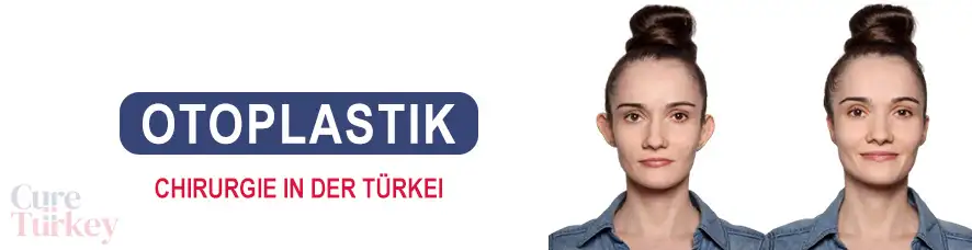 Otoplastik in der Türkei