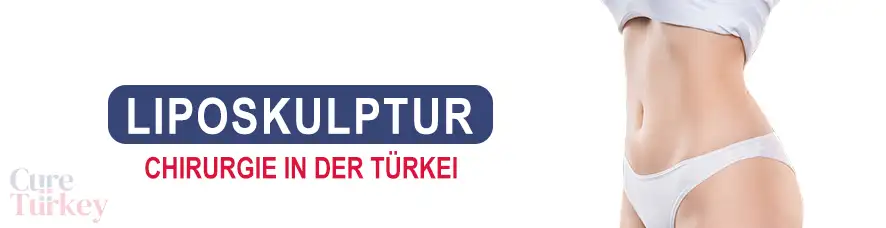 Liposkulptur in der Türkei