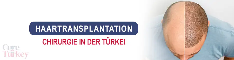 Haartransplantation in der Türkei
