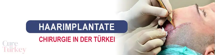 Haarimplantate in der Türkei
