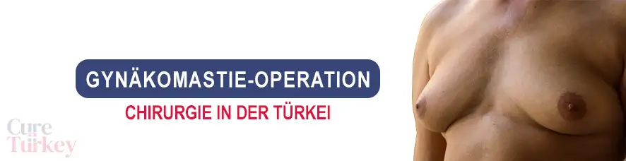 Gynäkomastie-Operation in der Türkei