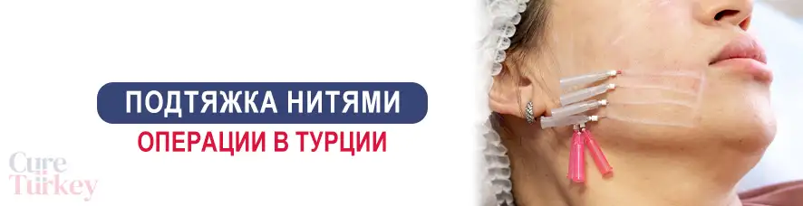 Подтяжка нитями