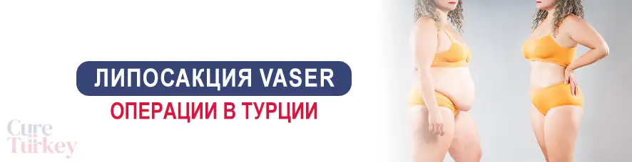 Bазер липосакция