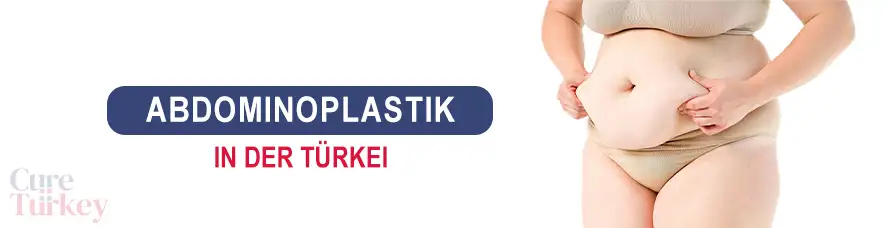 Подтяжка живота