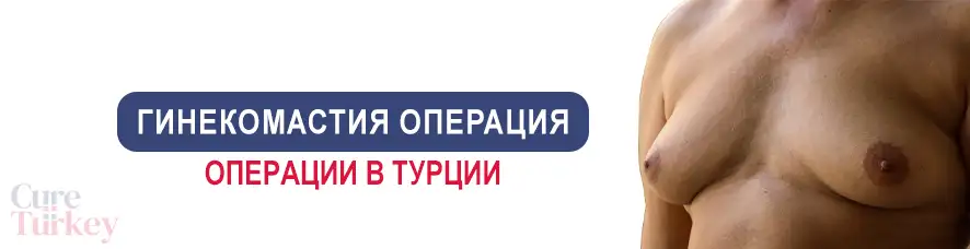 Гинекомастия операция