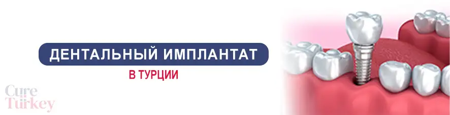 Дентальный имплантат