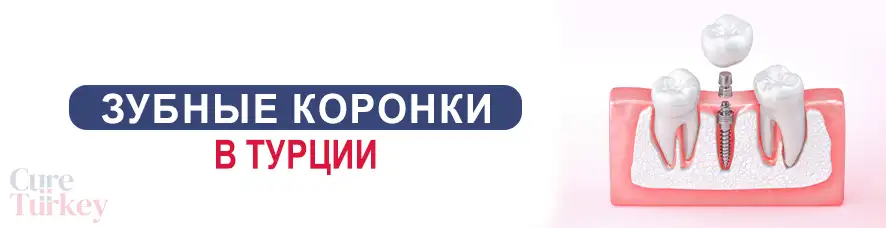 зубная коронка