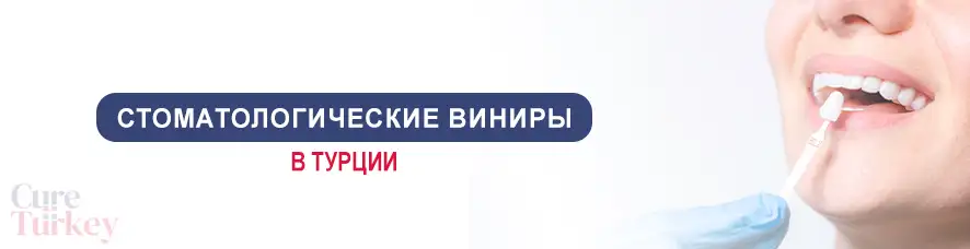 Стоматологические Виниры