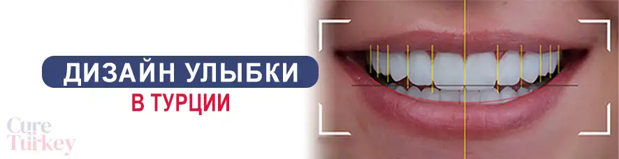 Дизайн улыбки