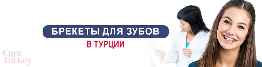 Брекеты для зубов