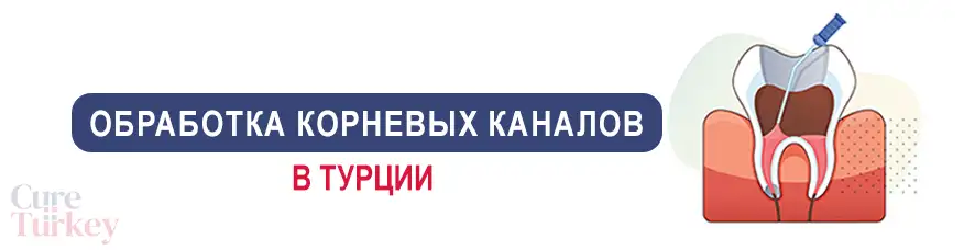 Обработка корневых каналов