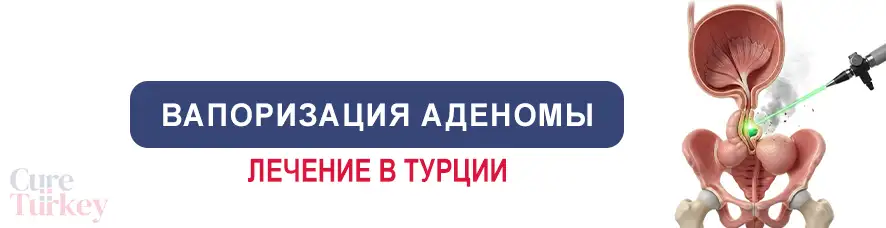 лазерная вапоризация аденомы простаты