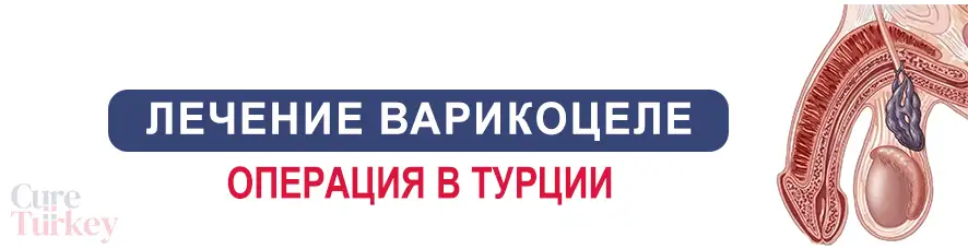 Варикоцеле лечение