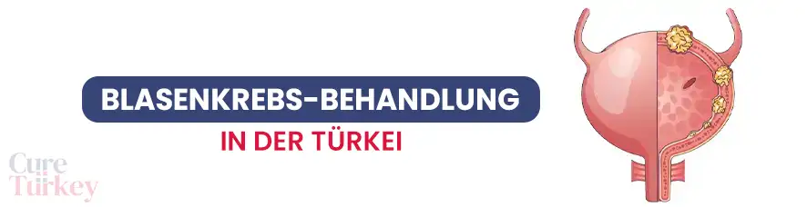 Blasenkrebs-Behandlung