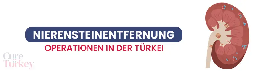 Operation zur Entfernung von Nierensteinen