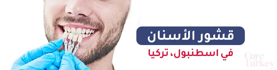 قشور الأسنان في اسطنبول