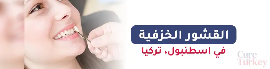 القشور الخزفية