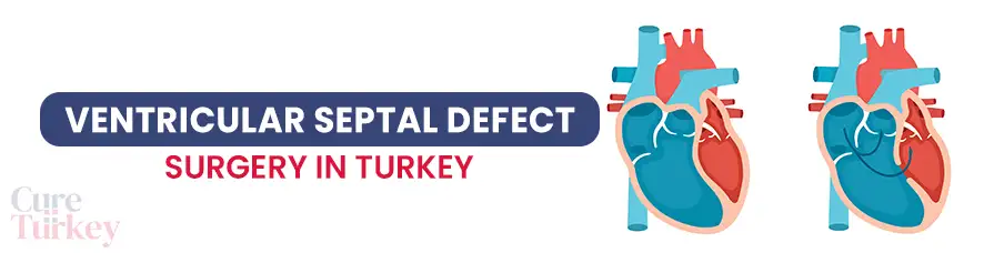 Ventricular Septal Defect