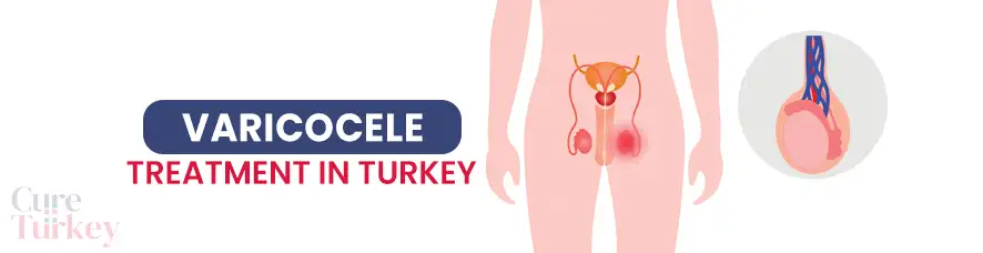 Varicocele Surgery