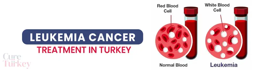 Leukemia
