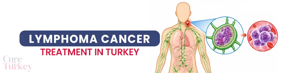 Lymphoma Treatment