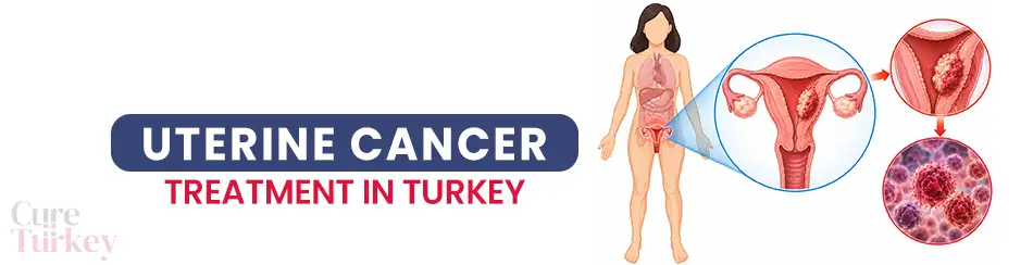 Uterine Cancer