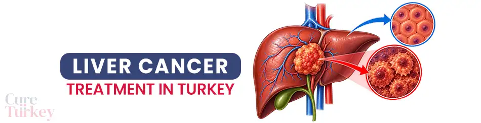 Liver Cancer