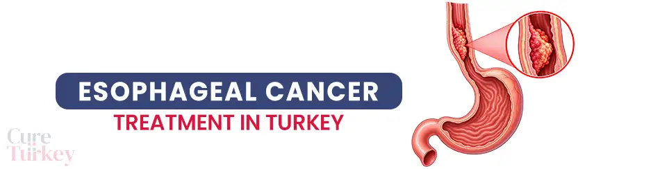 Esophageal Cancer