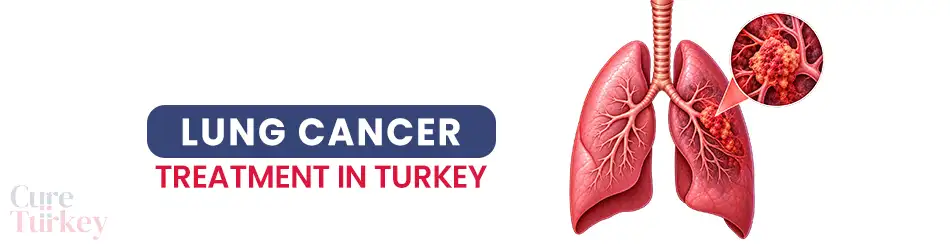 Lung Cancer