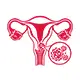 Cervical Cancer