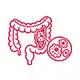 Colorectal Cancer
