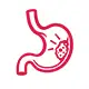 Stomach Cancer (Gastric Cancer)